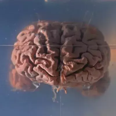 Default image