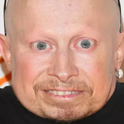 Default image